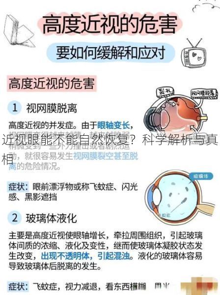 近视眼能不能自然恢复？科学解析与真相